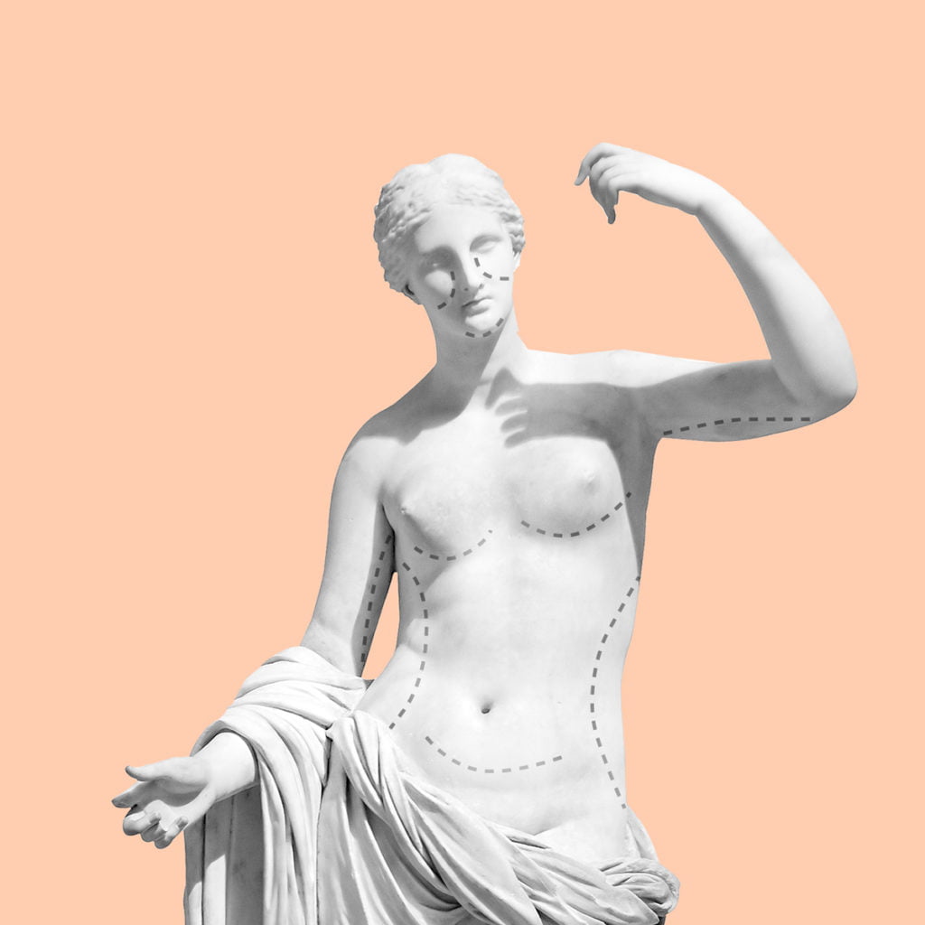 Montages photos d'une statue prête pour la chirurgie esthétique par  360Brain